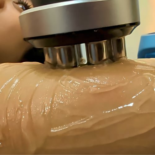 A contouring handpiece with metal rollers gliding over gel on a client's upper arm