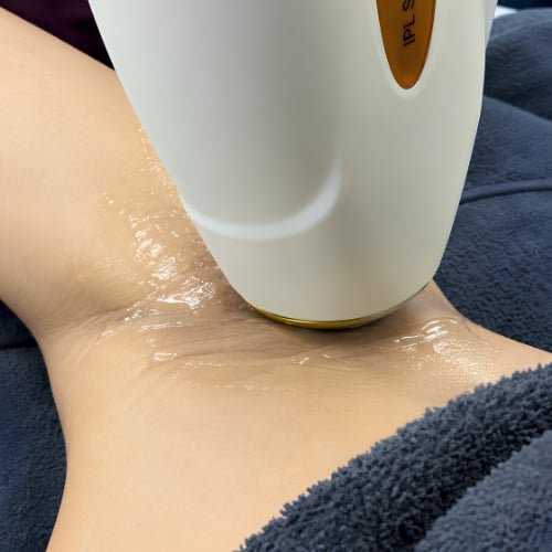 Inside The Better Face, where Chemical Peel is performed