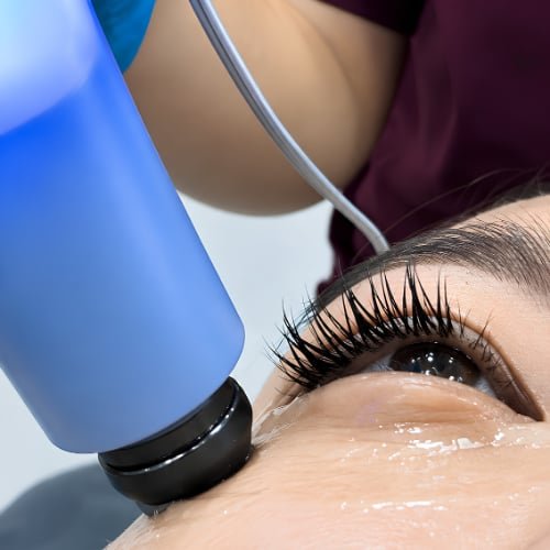 Exilis Treatment at The Better Face