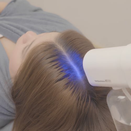 A client lying back while a needle-free device shines blue light along the hair parting