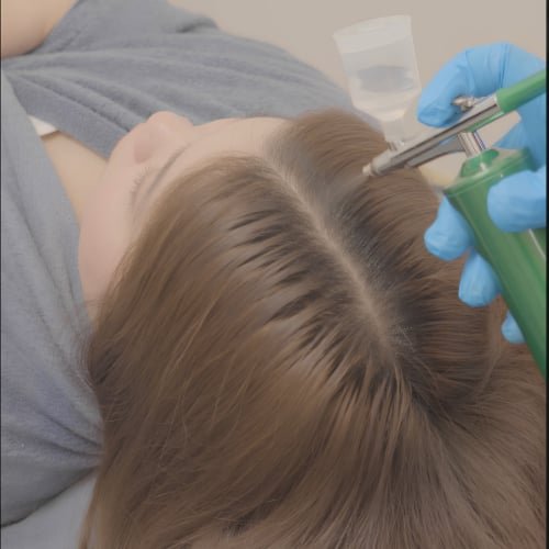 A clinician in blue gloves airbrushing solution onto a client's scalp along the parting
