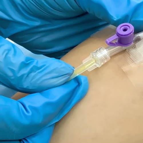 A clinician in blue gloves securing an IV line on a client's arm