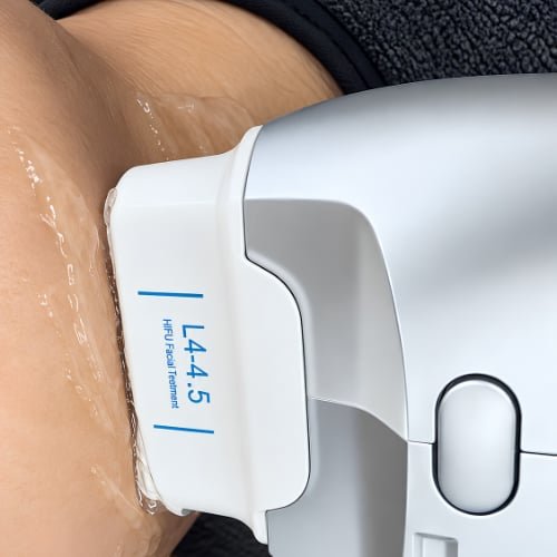 HIFU (High-Intensity Focused Ultrasound) at The Better Face