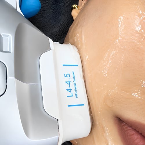 Inside The Better Face, where HIFU (High-Intensity Focused Ultrasound) is performed