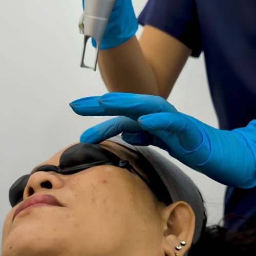 A clinician in blue gloves positioning a laser handpiece over a client wearing protective eye shields
