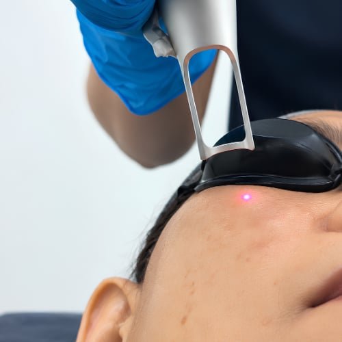 Inside The Better Face, where Non-Invasive Melasma Treatment is performed