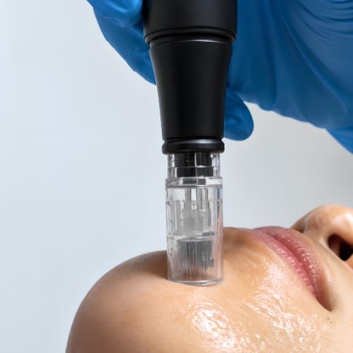 Inside The Better Face, where PRP (Platelet-Rich Plasma) is performed