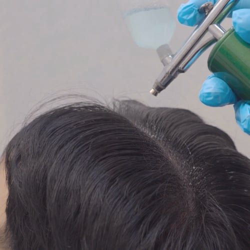 A clinician in blue gloves airbrushing treatment onto a client's scalp along the parting