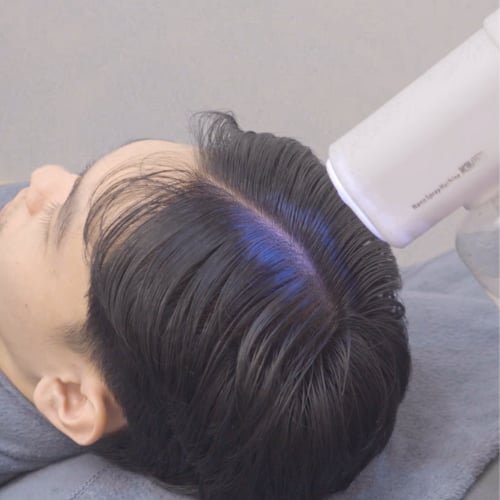 A client lying back while a handheld device shines blue light along the hair parting