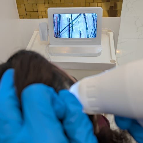 Scalp Anti-Dandruff Treatment at The Better Face